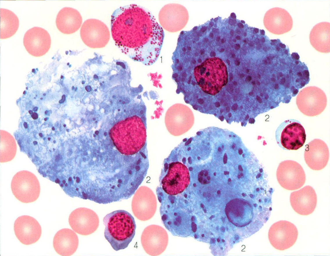 图294 原发性海蓝组织细胞增生症骨髓象(集中视野)